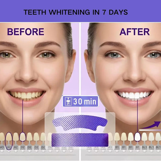 Purple Teeth Whitening Strips – 14 Treatments, 30-Minute Application