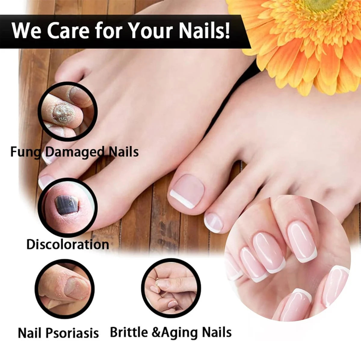 Fungal Nail Care Oil – Nail Repair & Conditioning Treatment, 50 ml