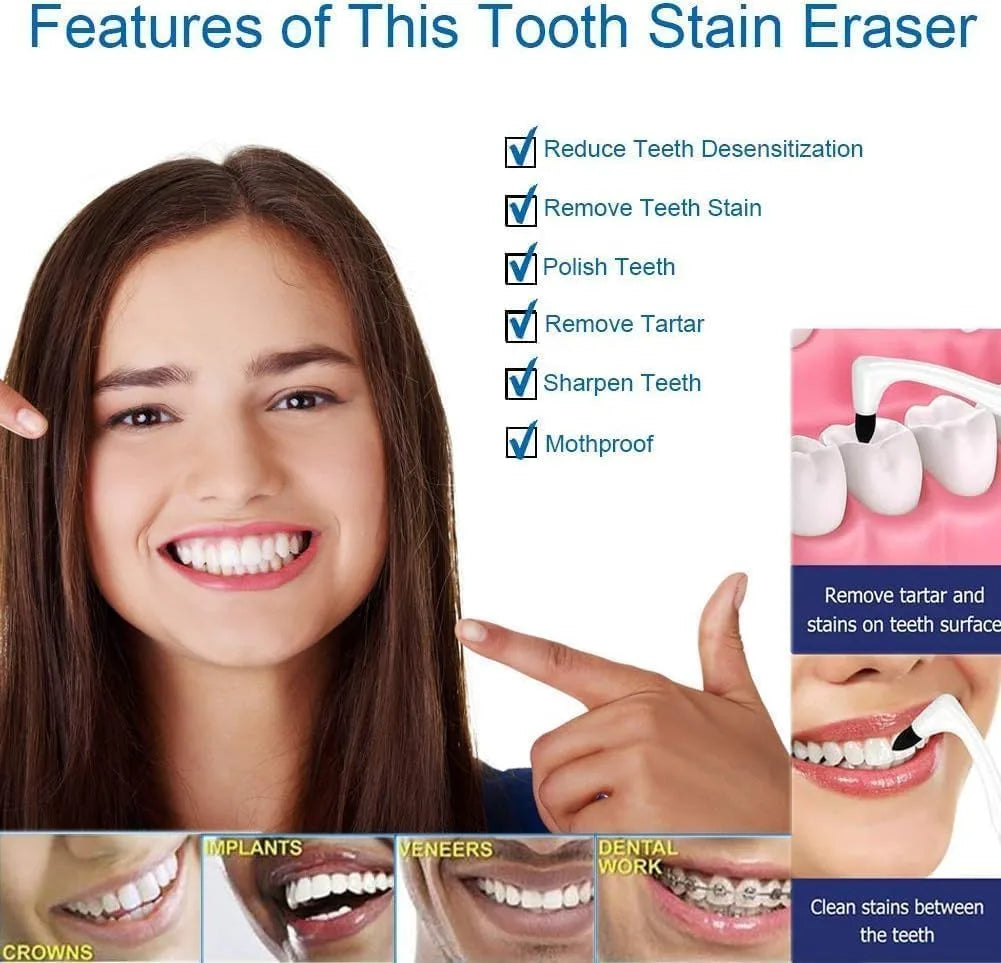 Spin Smile Electric Tooth Polisher with LED Light – 4 Polishing Tips