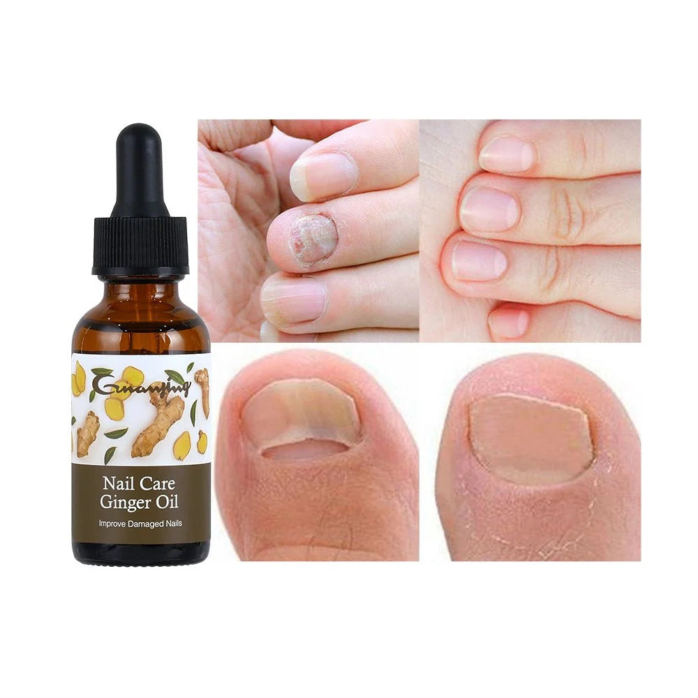 Guanjing Ginger Nail Care Oil 30ml – Nail & Cuticle Conditioning Oil