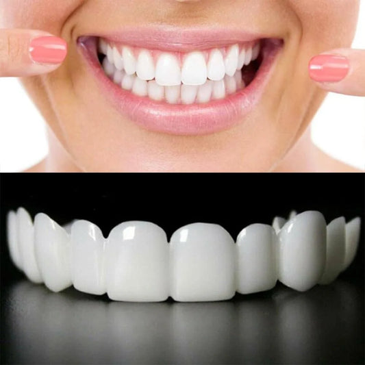 Snap-On Smile Cosmetic Teeth Cover – Removable Smile Enhancer with Storage Case