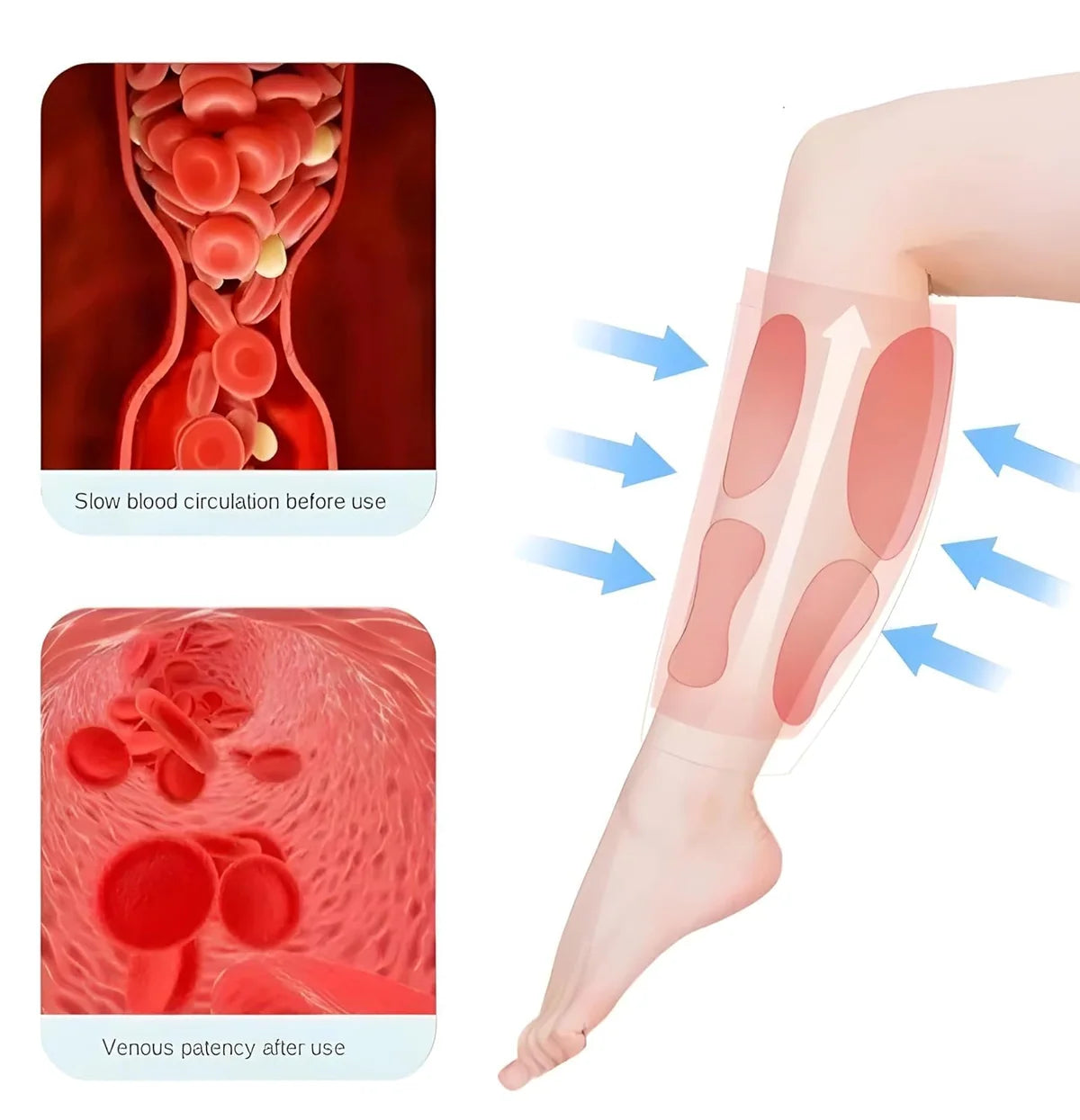 S6 Cordless Leg Massager – Full-Wrap Air Compression Massage Device