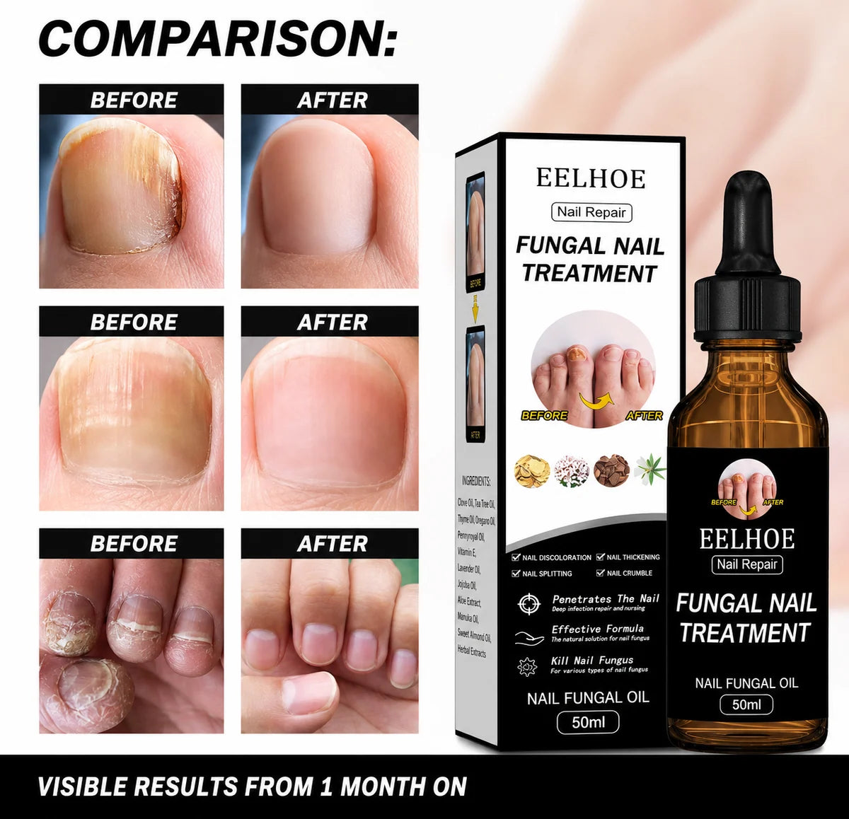 Fungal Nail Care Oil – Nail Repair & Conditioning Treatment, 50 ml