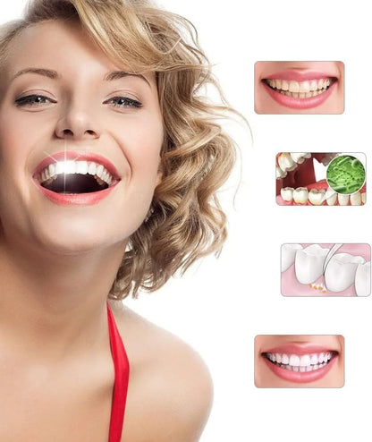 Spin Smile Electric Tooth Polisher with LED Light – 4 Polishing Tips