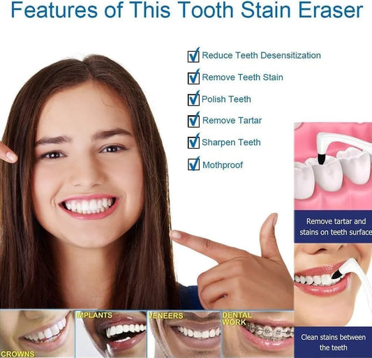 Spin Smile Electric Tooth Polisher with LED Light – 4 Polishing Tips