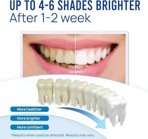 Spin Smile Electric Tooth Polisher with LED Light – 4 Polishing Tips