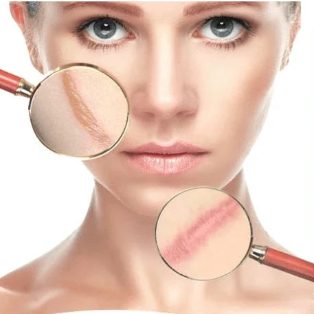 Aichun Beauty Scar Care Gel 20g – Skin Smoothing & Conditioning