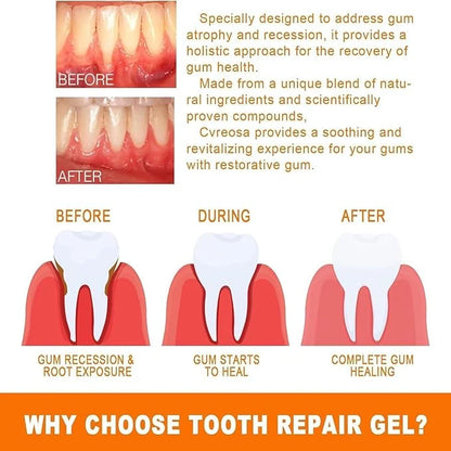 Eelhoe Gum Care Essence Ampoules – 7 × 1.5ml Oral Care Treatment