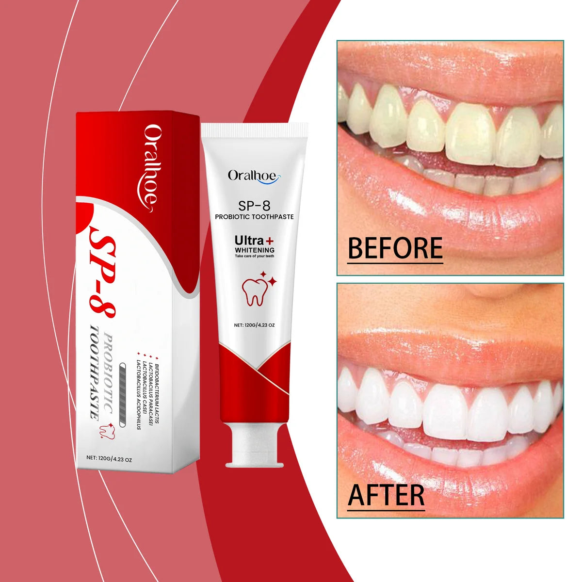 Oralhoe SP-8 Probiotic Toothpaste – Daily Oral Care, 120 g