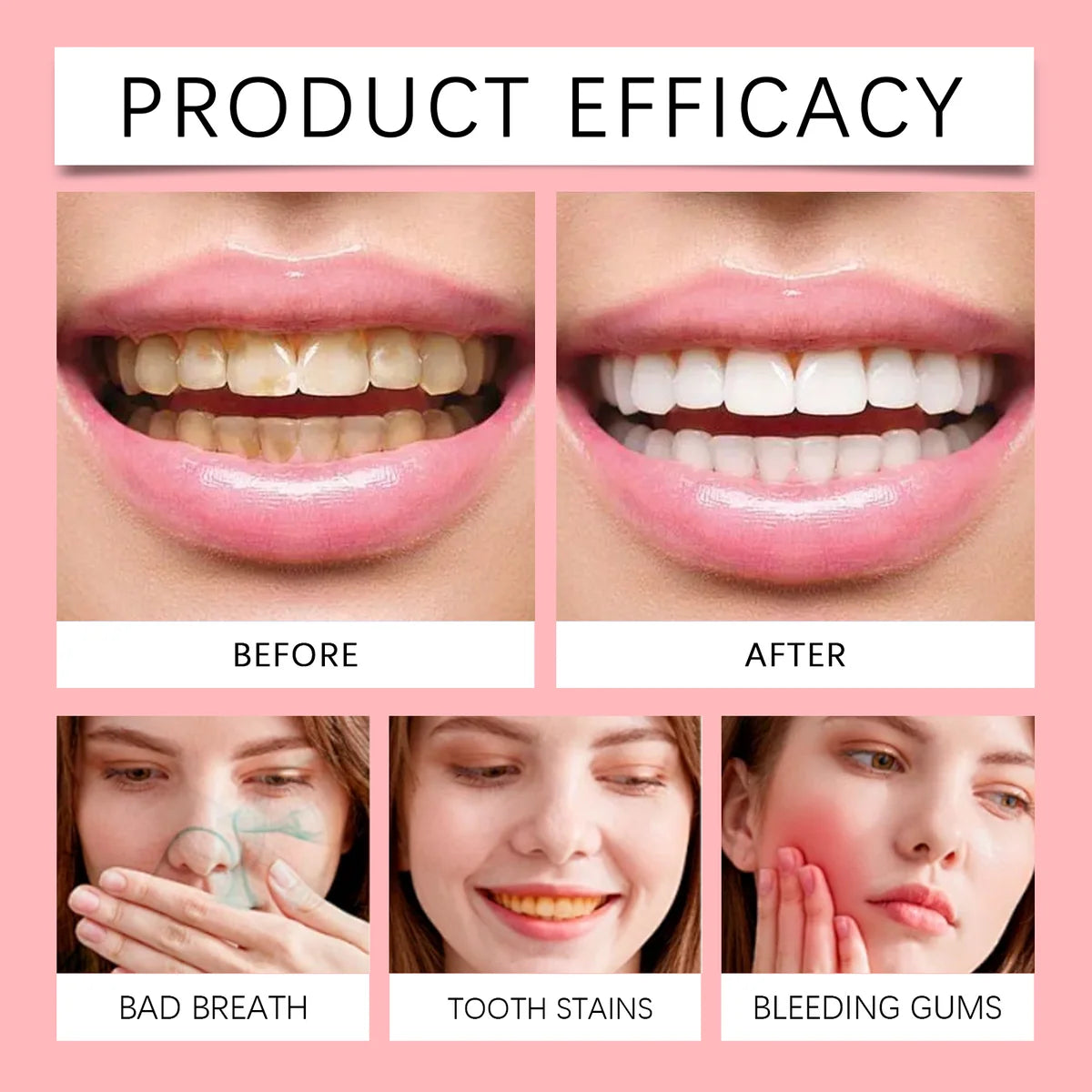 Oralhoe SP-8 Probiotic Toothpaste – Daily Oral Care, 120 g