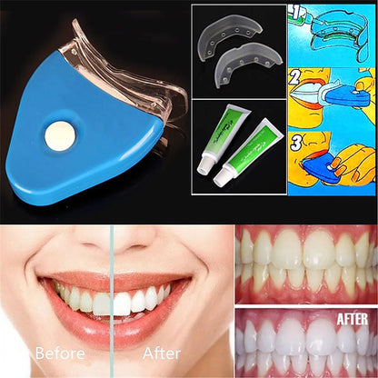 LED Teeth Whitening Kit with Whitening Gel – At-Home Oral Care System