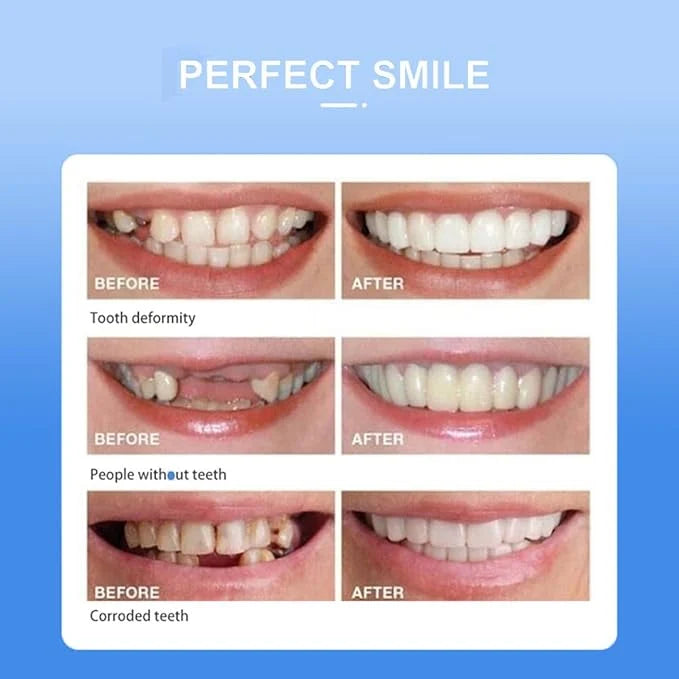 Snap-On Smile Cosmetic Teeth Cover – Removable Smile Enhancer with Storage Case