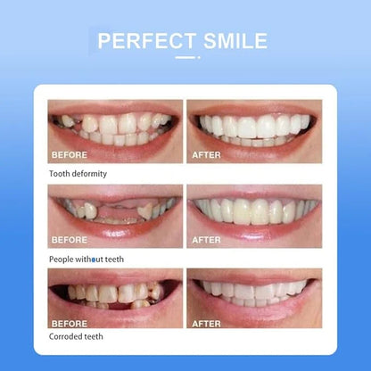 Snap-On Smile Cosmetic Teeth Cover – Removable Smile Enhancer with Storage Case